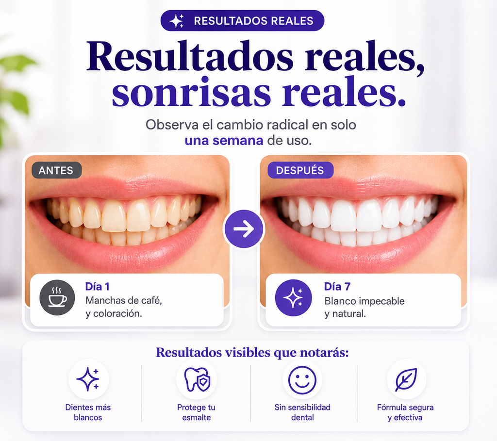 RECUPERA TU SONRISA Y TU CONFIANZA (TIRAS BLANQUEADORAS)✨
