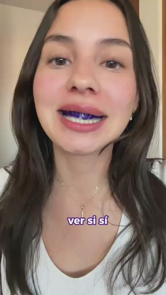 RECUPERA TU SONRISA Y TU CONFIANZA (TIRAS BLANQUEADORAS)✨